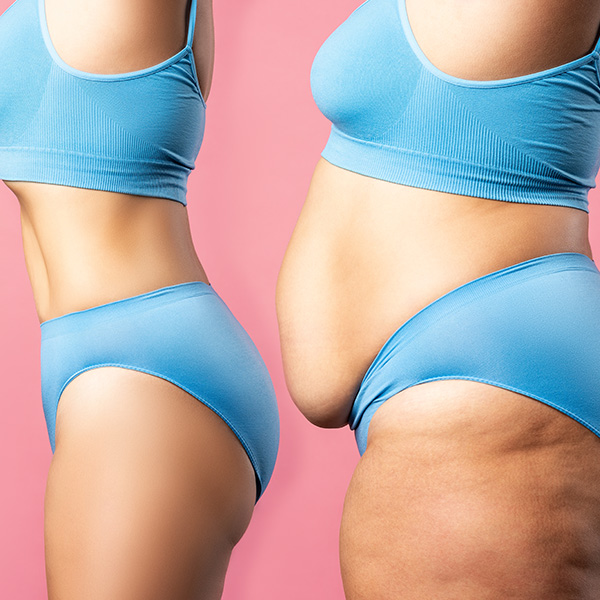 before and after side-view, weight loss picture of a woman in a light blue bra and panty. The image on the left shows the woman having lost her weight displaying a slender profile while the woman on the right displays a protruded belly and thicker legs.